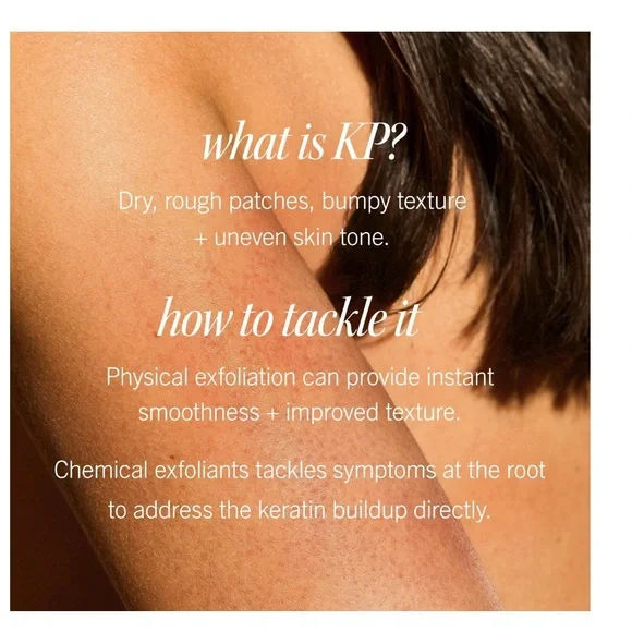 First Aid Beauty - KP Bump Eraser Body Scrub with 10% AHA - Picture 5 of 7